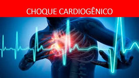 choque cardiogenico - choque anafilactico